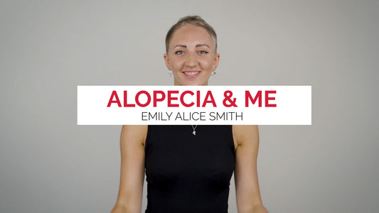 Living with Alopecia: Emily's Inspiring Journey with Alopecia Hair Loss