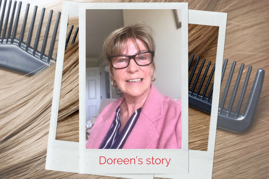 Doreen's Story: Wearing a Wig for Alopecia