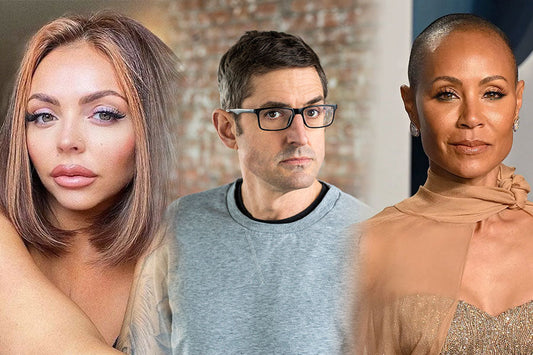 Celebrities with Alopecia: 15 Famous People Sharing Their Hair Loss Journey